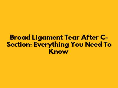 Broad Ligament Tear After C-Section: Everything You Need To Know