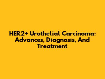 HER2+ Urothelial Carcinoma: Advances, Diagnosis, And Treatment