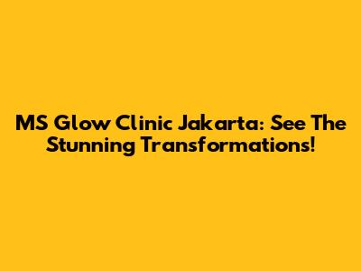 MS Glow Clinic Jakarta: See The Stunning Transformations!