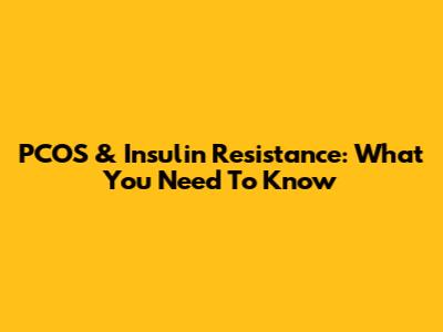 PCOS & Insulin Resistance: What You Need To Know