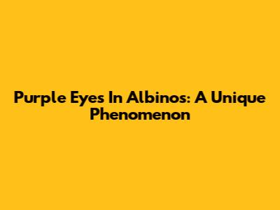 Purple Eyes In Albinos: A Unique Phenomenon