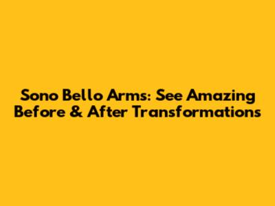 Sono Bello Arms: See Amazing Before & After Transformations