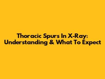 Thoracic Spurs In X-Ray: Understanding & What To Expect