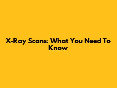 X-Ray Scans: What You Need To Know